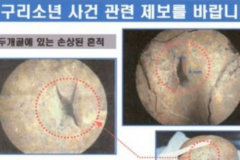 개구리 소년들을 죽게 만든 미스터리한 살인 도구의 정체