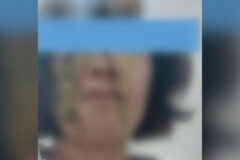 교사의 안경이 부러질 정도로 얼굴에 똥기저귀 싸대기 때린 학부모의 최후